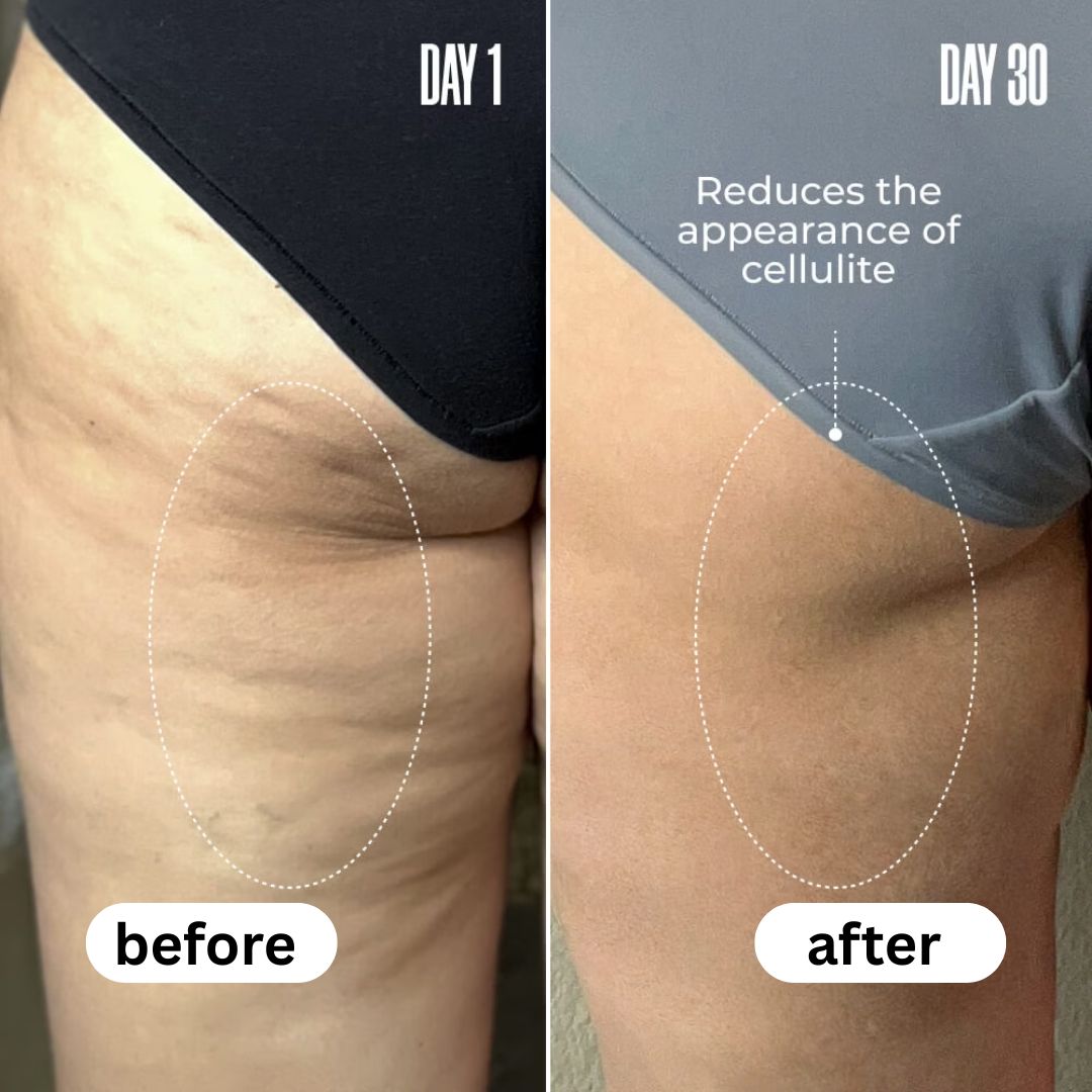 NovaCare Anti-Cellulite Massage Oil