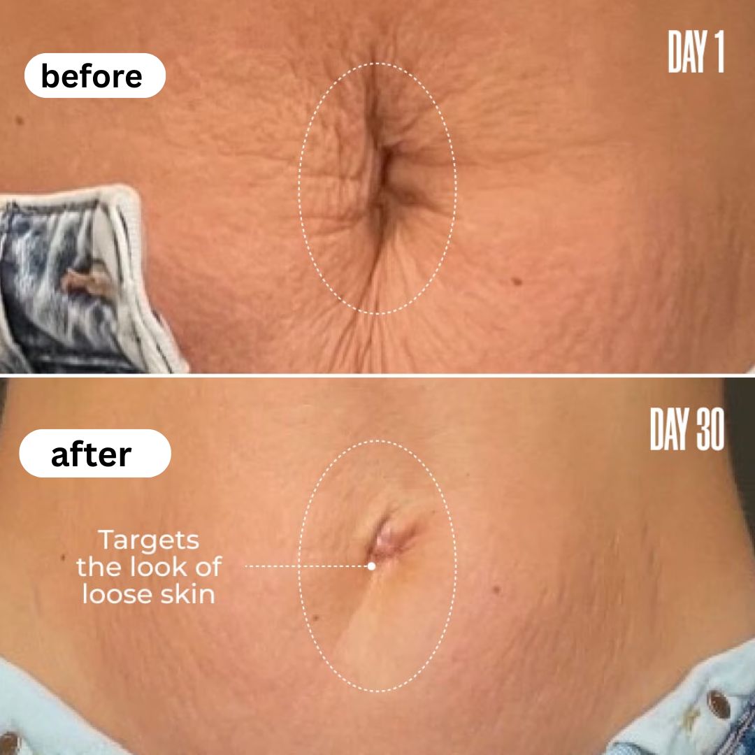 NovaCare Anti-Cellulite Massage Oil