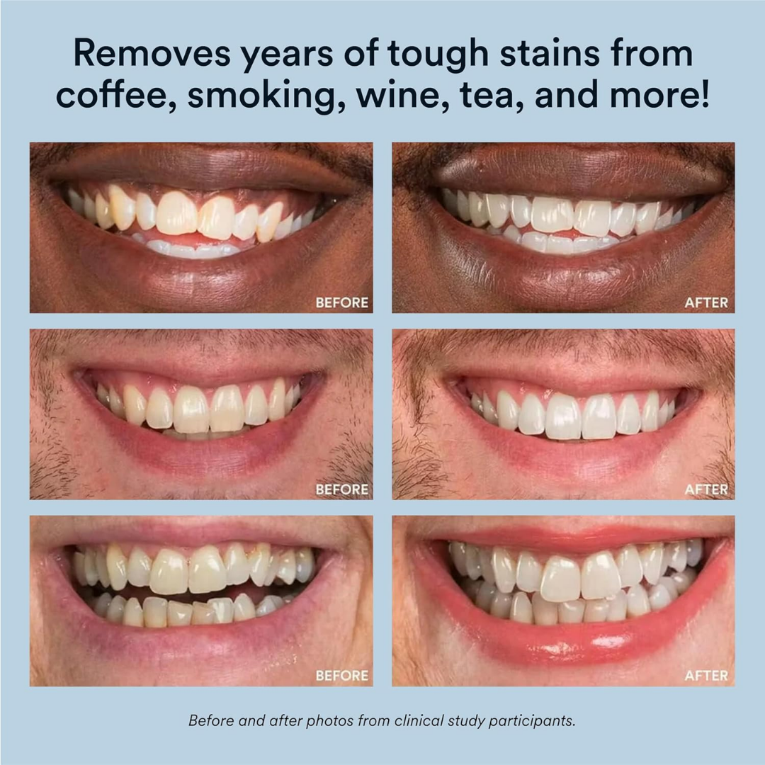 Snow-Teeth Whitening Powder