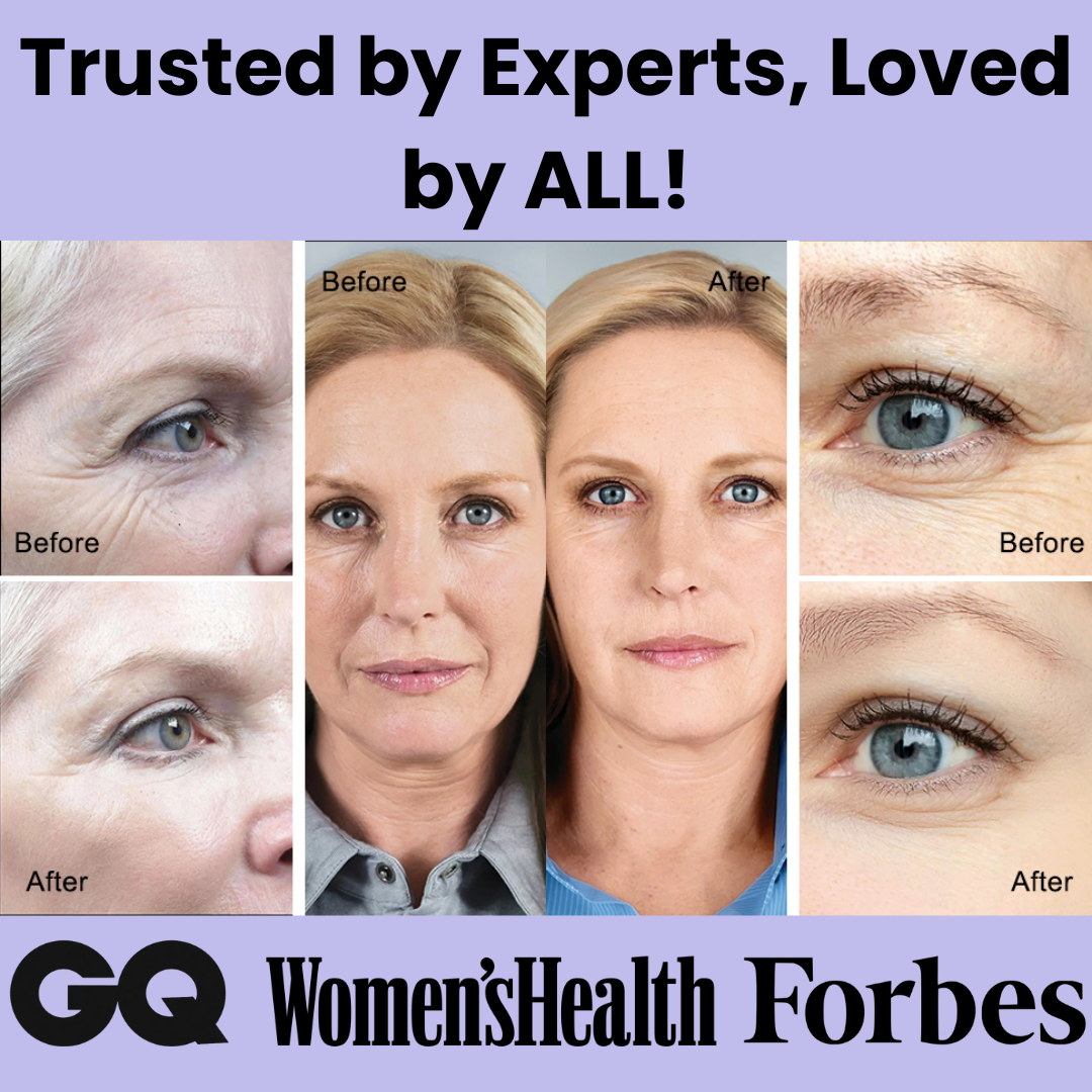 LumiLift ™ Red Light Eye Therapy