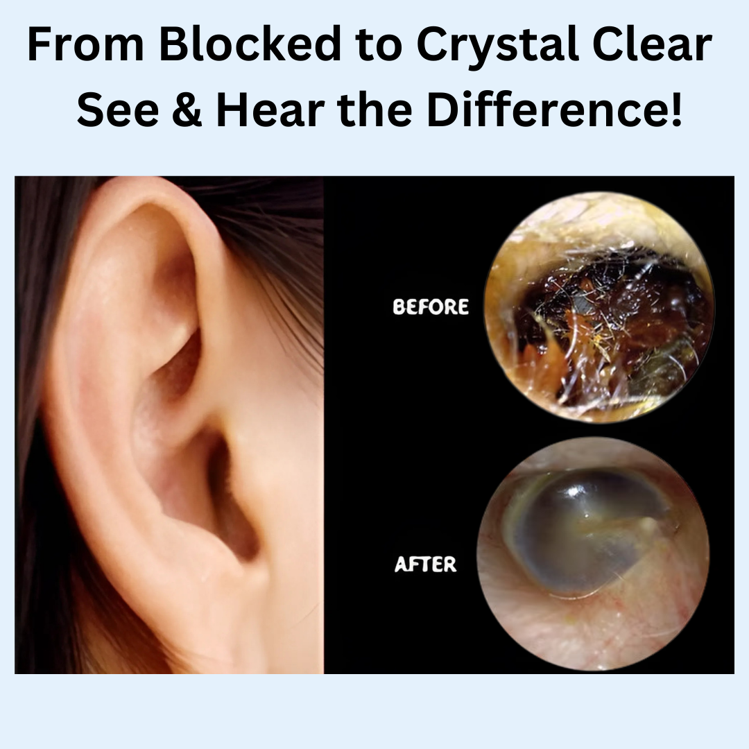 SonicClear Earwax Remover