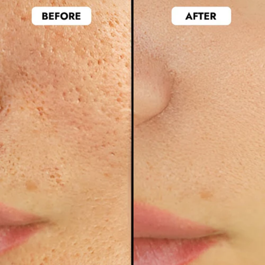 GlowLift Pore Solution