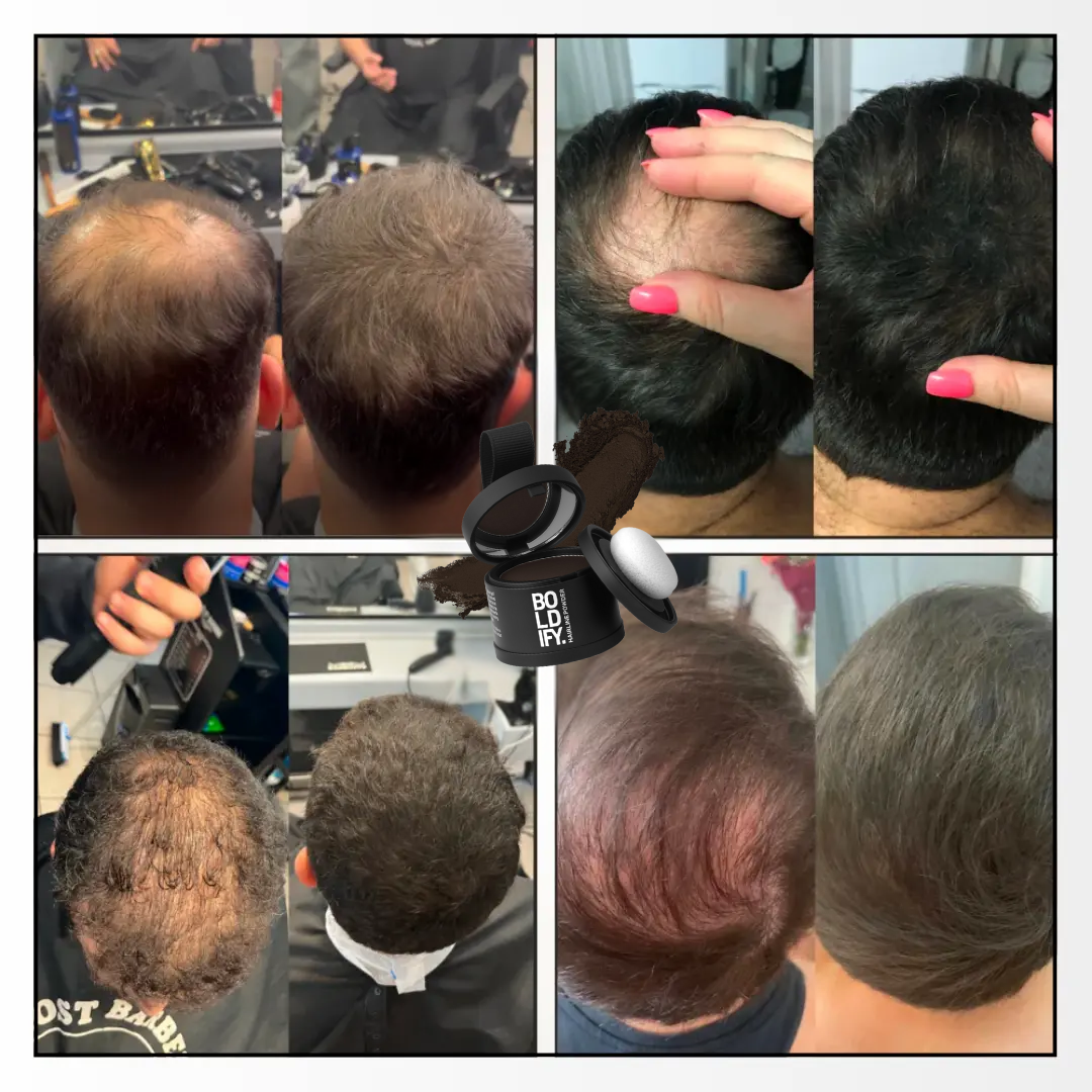 Crown Hair-Guard