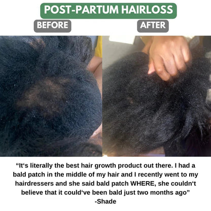 NovaCare Postpartum Comeback-Oil™