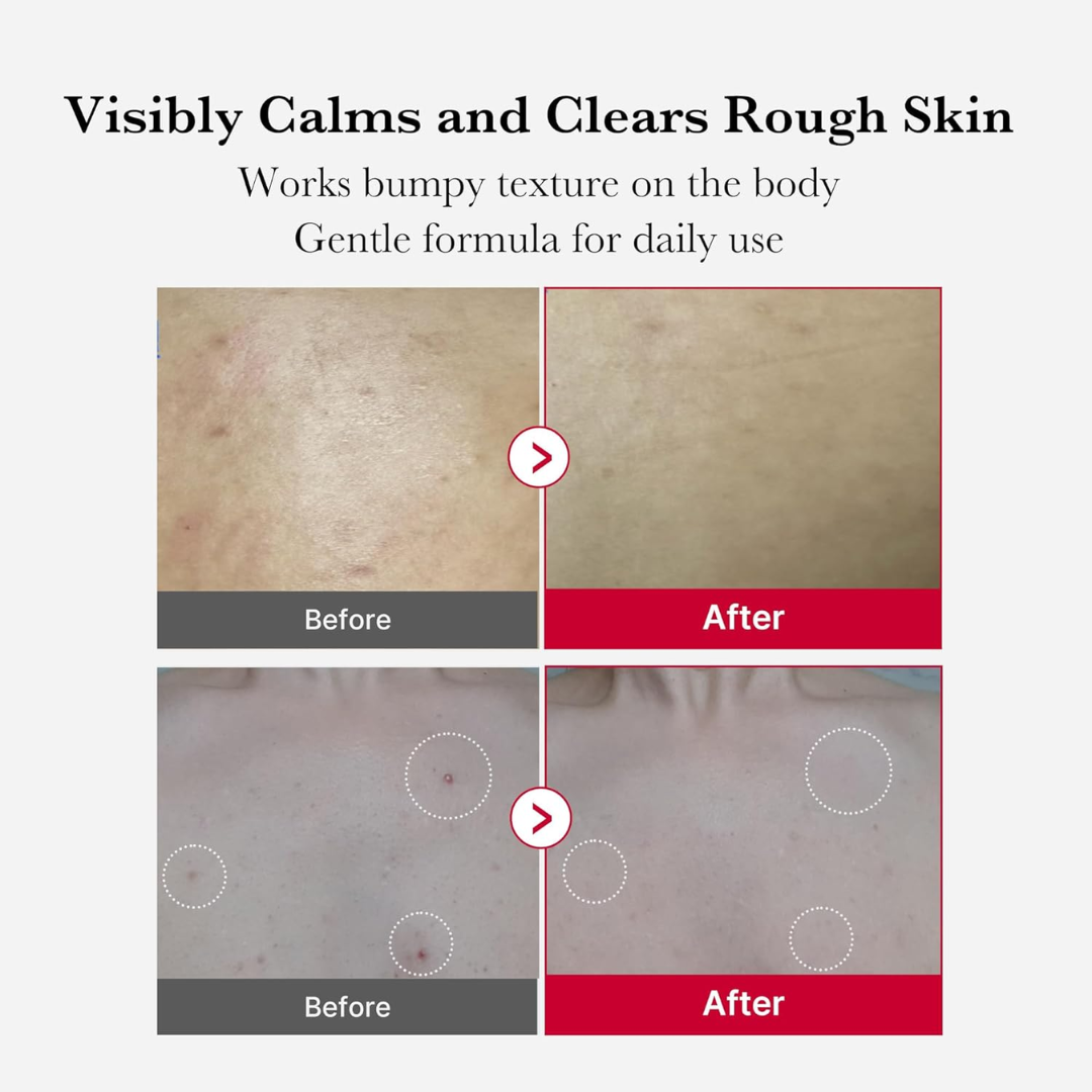 Zivara Exfoliating Body Spray