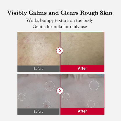 Zivara Exfoliating Body Spray