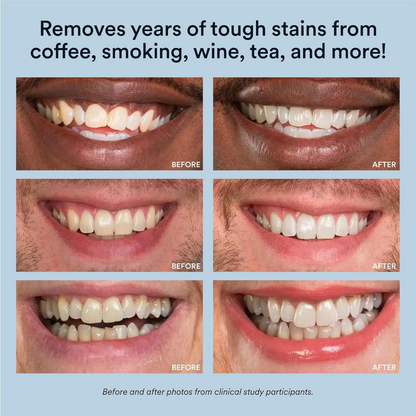 Snow-Teeth Whitening Powder