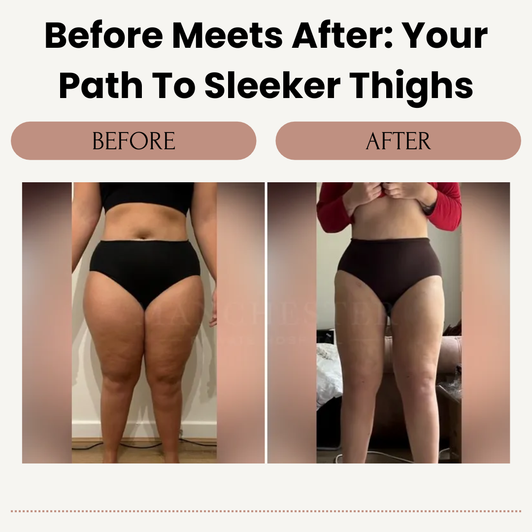 NovaCare™ Thigh Toner