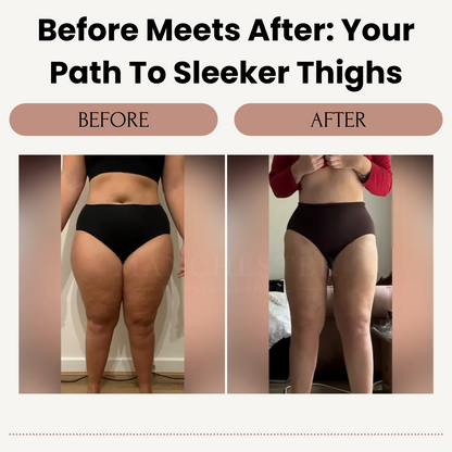 NovaCare™ Thigh Toner