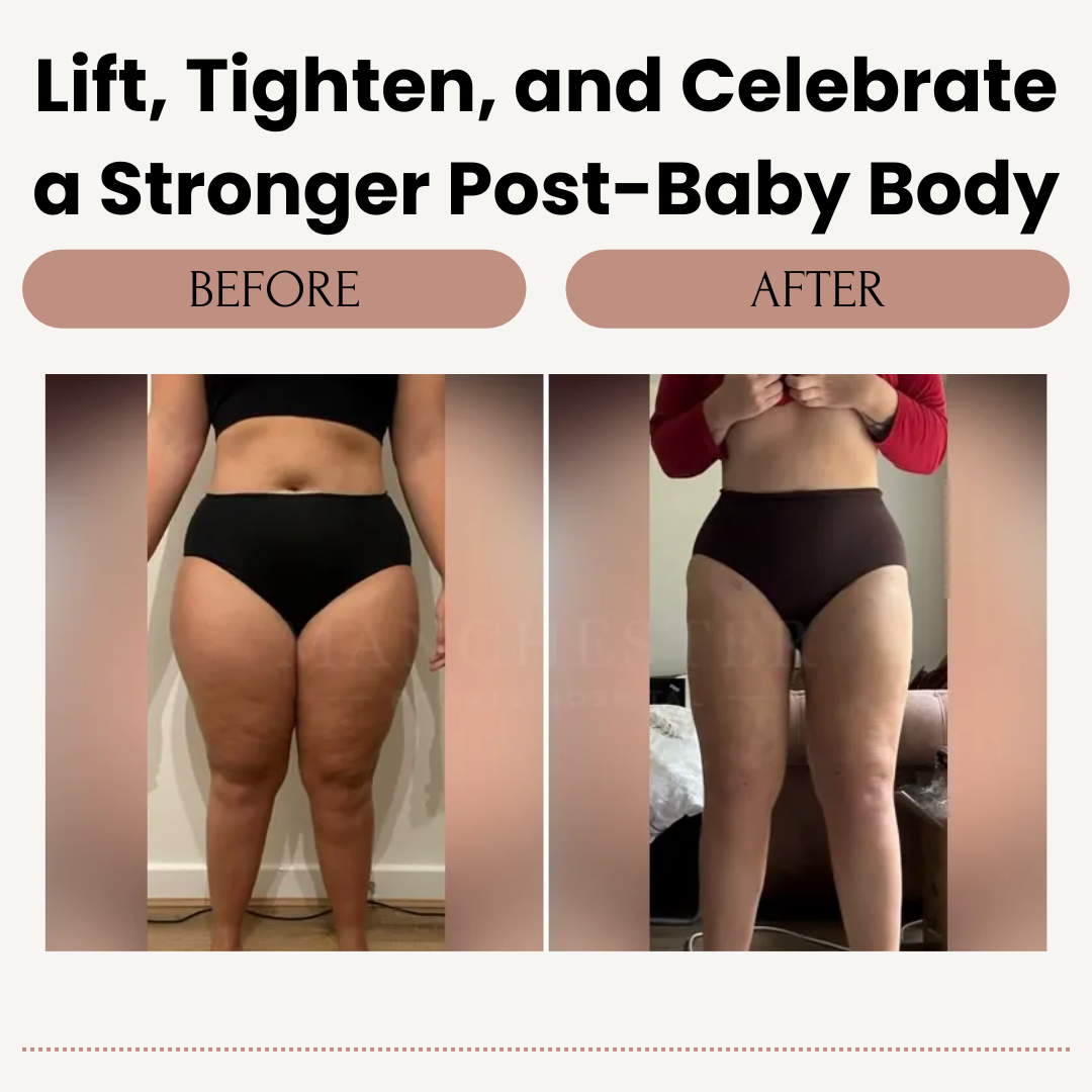 NovaCare™ Pelvic Trainer