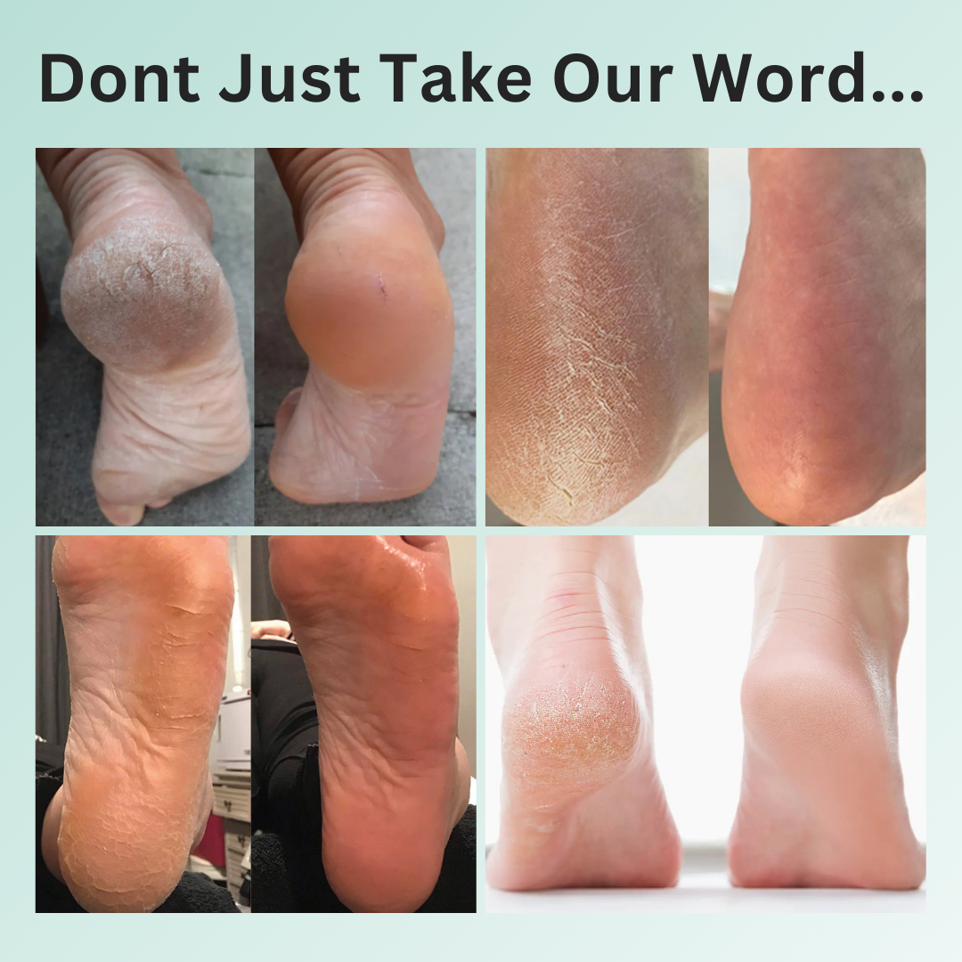 old foot cream