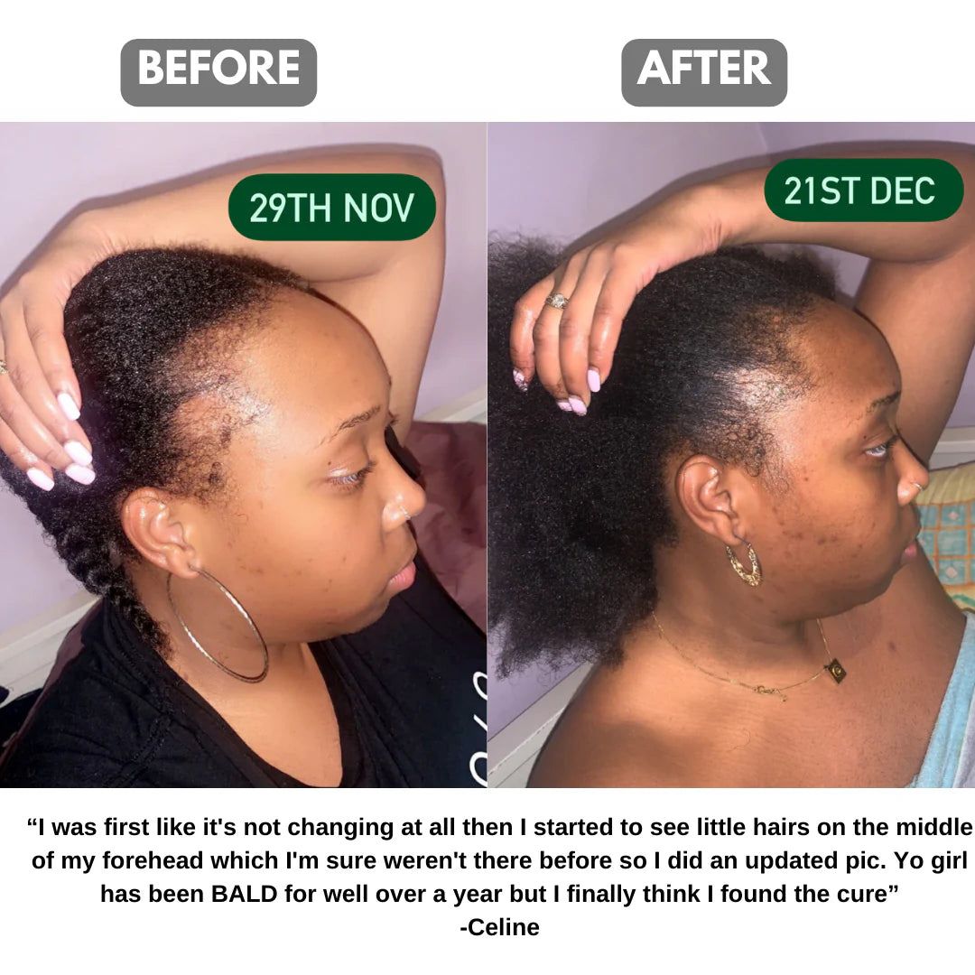 NovaCare Postpartum Comeback-Oil™