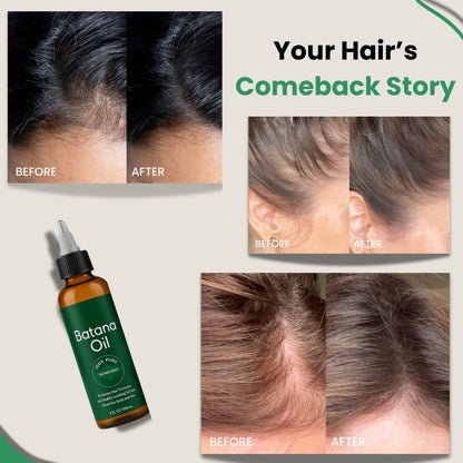 NovaCare Natural Batana-Oil