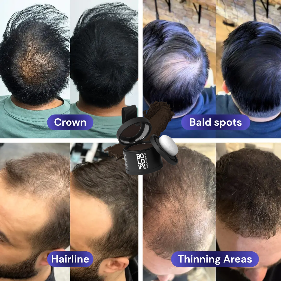 Crown Hair-Guard