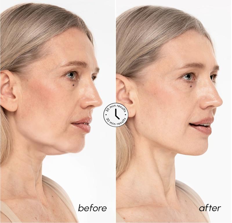 PureLift Jaw Mask
