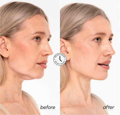 PureLift Jaw Mask